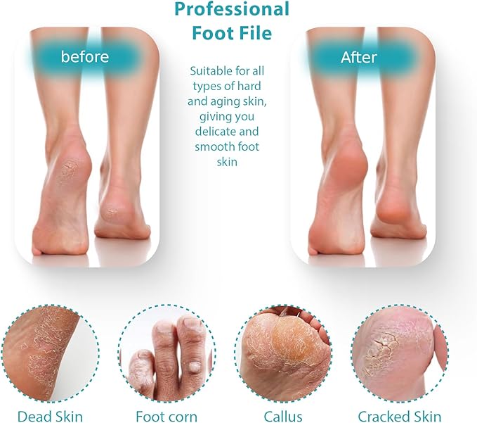 Foot File Pedicure Tool, Foot Callus Remover, Durable Foot Scrubber, Dead Skin Remover,Professional Toe Cleaning Brush, Long-Lasting Foot Polisher
